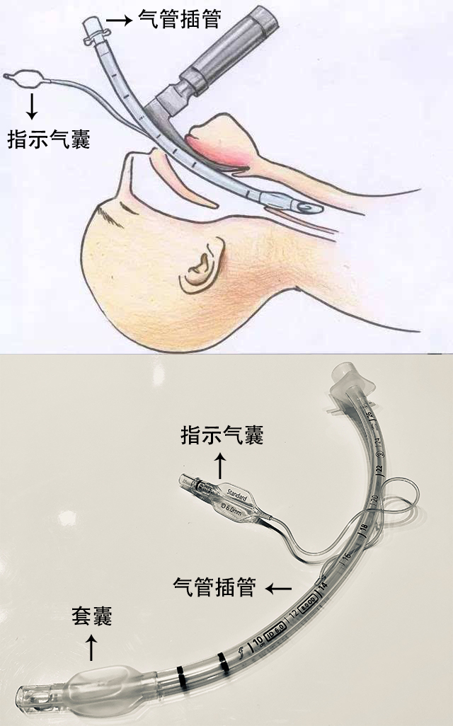 贊?。。?50萬指示氣囊，客戶100%滿意！